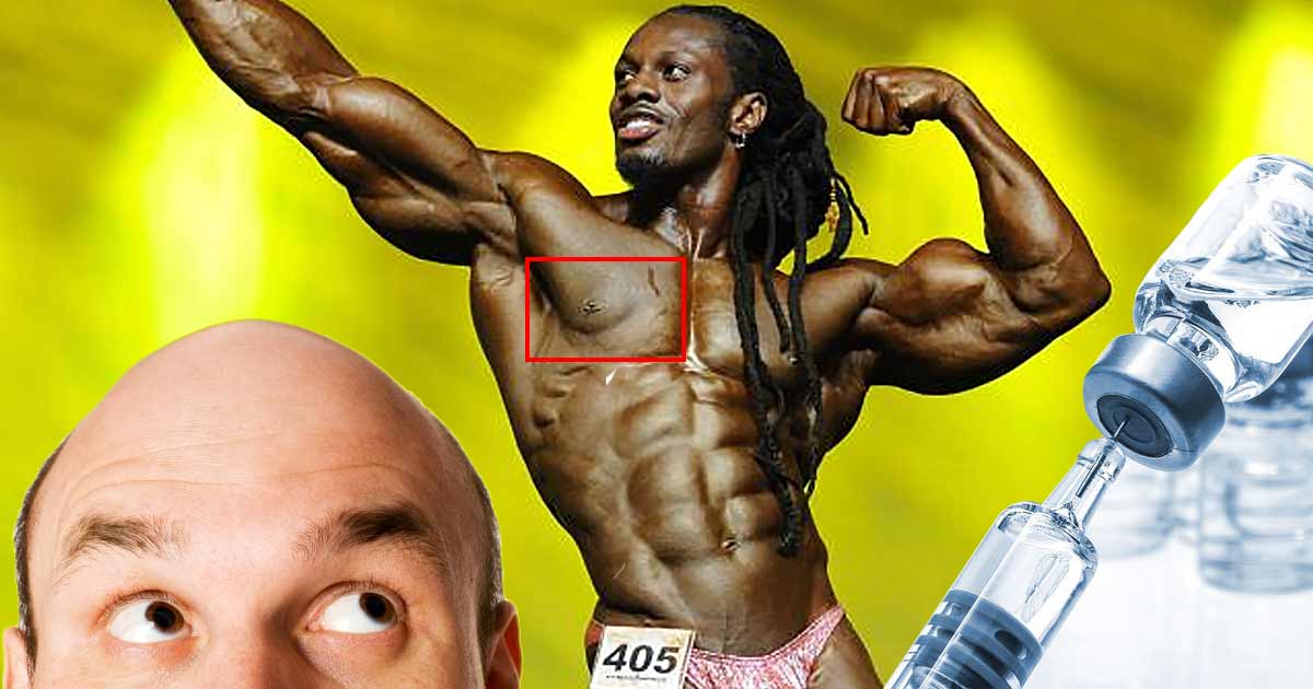 Der vollständige Leitfaden zum Verständnis von anabolika kur