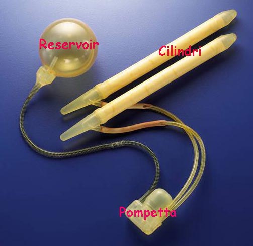 Trovare clienti con generico online Parte B