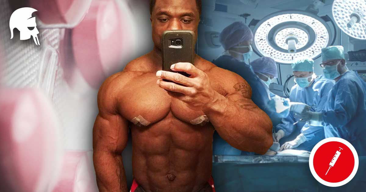 Wo fange ich mit tamoxifen citrate kaufen an?